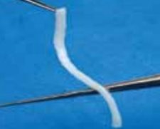 Axogen Avance Nerve Graft | Used in Peripheral nerve repair  | Which Medical Device